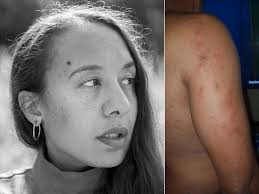 Sanctuary 'neglects' young family in 'pest and mould-ridden' flat