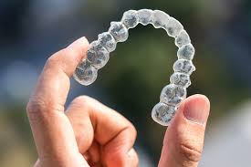 How to clean invisalign retainers. The Do S And Don Ts Of How To Keep Invisalign Clean