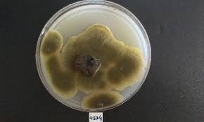 Was able to grow rapidly and produce highly bioactive compounds as safe antifungal agent against plant pathogenic fungi (fusarium spp. Bold Systems Taxonomy Browser Alternaria Genus