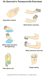 Image Result For Exercises For De Quervain S Tenosynovitis Hand Therapy Exercises Hand Therapy Physical Therapy Exercises