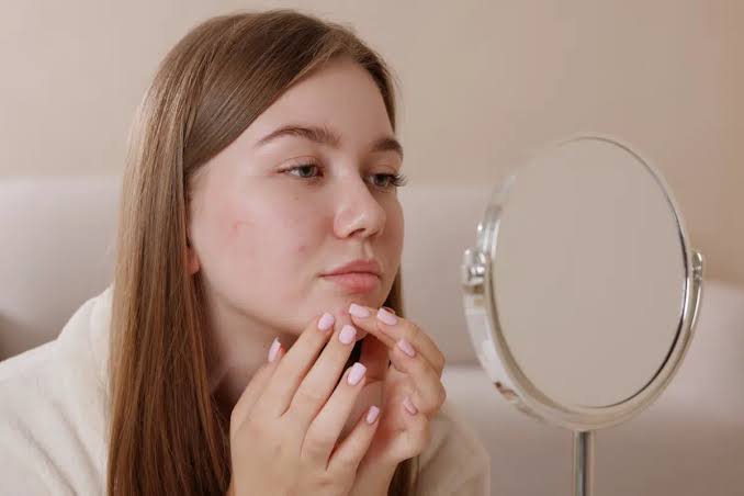 Sua pele piorou depois do skincare? 5 erros que podem causar oleosidade,  irritação e espinhas - Portal EdiCase