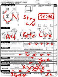 The clock drawing test can be used to test patients you suspect might have mild cognitive impairment or alzheimer's disease. Can You Do Better At The Moca Test Than Trump 9gag