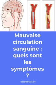 Epingle Sur Forme Bien Etre