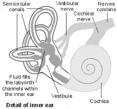 Image result for Bacterial Labyrinthitis