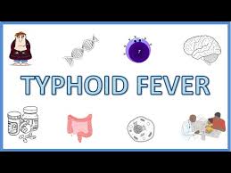 Image result for Typhoid Fever