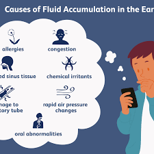 Maybe you would like to learn more about one of these? Otitis Media With Effusion Treating Fluid In The Ear