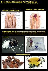 Pin On Home Remedies