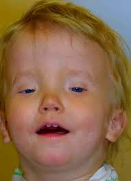 Image result for Blepharis transvaalensis