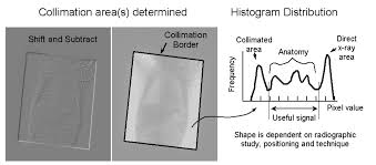 Del size determines resolution for flat panel systems. Https Medicalphysics Org Documents Goldmanch06 Pdf