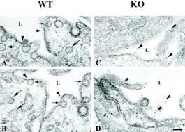 Check spelling or type a new query. Caveolae Deficient Endothelial Cells Show Defects In The Uptake And Transport Of Albumin In Vivo Journal Of Biological Chemistry