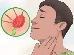 How To Check Lymph Nodes: 12 Steps (With Pictures) - Wikihow