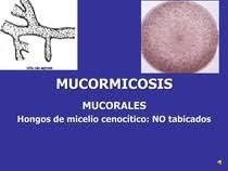 Pía w, spalloni m, glaser s, verdugo p. Mucormicosis Micologia