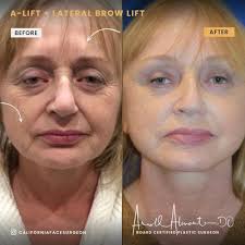 TOP 10 BEST Dr Wes Hill in Roseville, CA