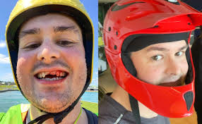 Telco super-geek Liam Farr makes bloody case for a full-face helmet