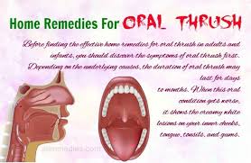Pin By Vickie Burgess On Home Remedies Natural Home Remedies Holistic Health Remedies Natural Remedies