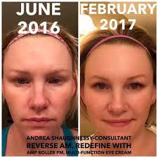 What would you change about your skin?