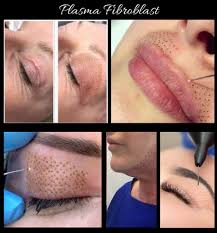 Fibroblast Plasma Pen Skin Tightening Training Atsci