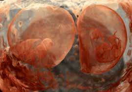 Cultureshift On Wordpress Com Fetal Development Neurology Rehabilitation