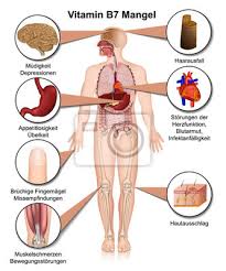 Vitamina D Mangel Anzeichen Und Symptome Ilustracao Vetorial Pinturas Para A Parede Quadros Esclerose Alta Pressao Arterial Escassez Myloview Com Br