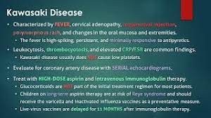 Kawasaki Disease Youtube