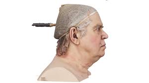 Raw Head Scan Joachim Groom