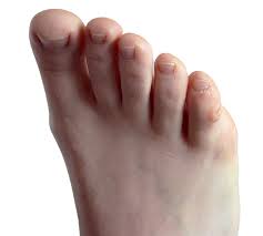 Image result for Corns