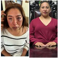 Justicia para Míriam! Protestas en Capulhuac Exigen la Destitución de la  Alcaldesa Selene Hernández Herrera tras Agresión