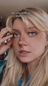 I’ve only ever had fake teeth that matched my real ones ONCE🥲