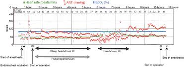 Anesthetic Chart Art Arterial Blood Pressure Et Co2 End