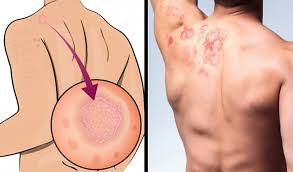 Điều kinh khủng gì sẽ xảy ra nếu bạn không tắm? | VOV.VN