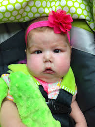 Happy St. Patrick's Day! My sweet girl dressed all up for one of her  favorite nurses who happens to be a little Irish. 💚 Sadly, she was off  today but we took