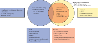 Their symptoms usually come on slowly, so you might not even notice them. Iron Deficiency The Lancet