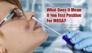 We did not find results for: What Does It Mean If You Test Positive For Mrsa