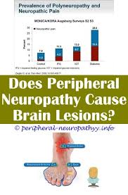 Pin On Neuropathy Definition