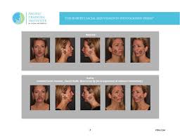 Rejuvenate aesthetic courses provide hands on aesthetics training for doctors, dentists, dental therapists, . Non Injector Botox Training For Dental Medical Practice Ptifa