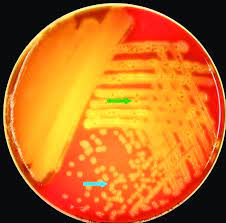 It can cause miscarriages in pregnant women. Mixed Culture Of Streptococcus Pneumoniae And Listeria Monocytogenes On Download Scientific Diagram