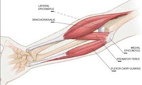 Golfer's elbow causes pain that starts on the inside bump of the elbow, the medial epicondyle. 10 Things I Ve Learned About Climber S Elbow Or Medial Epicondylitis John Roberts