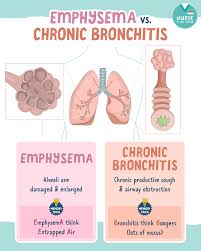 Image result for Emphysema