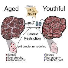 While it can decrease life expectancy and quality of life, there are actions you. Molecular And Functional Networks Linked To Sarcopenia Prevention By Caloric Restriction In Rhesus Monkeys Sciencedirect