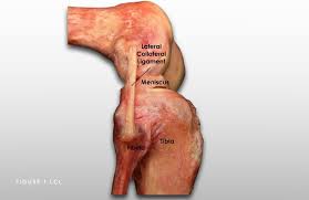 We did not find results for: Lateral Collateral Ligament Lcl Tear Chicago Il Jorge Chahla Md