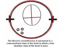 Fetal Biometry Calculator Ii