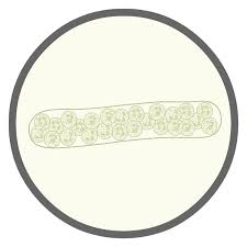 Image result for Urinary Cast