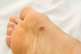 What is the part of his everyday work? Skin Cancer Foot And Ankle Specialists