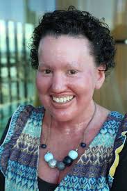 Americans With Disabilities Act anniversary Archives