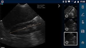 Early in pregnancy, ultrasounds are used to confirm the fetal heartbeat and the baby's position in your uterus. Vistascan Ultrasound App Apps On Google Play