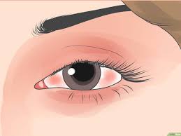 3 Formas De Hacer Que Tu Ojo O Ceja Dejen De Saltar