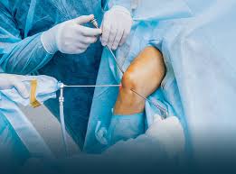Sports specialty hospitals are still minimal in india as compared to rest of the world. Best Sports Medicine Arthroscopic Surgery Hospital In India Sports Medicine Arthroscopic Surgery Treatment Fortis Healthcare
