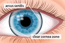 Image result for Cornea
