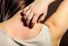 Many are under the misguided dry skin: 12 Effective Home Remedies To Get Rid Of Itching On Skin