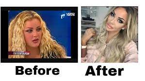 Găsești toate informațiile despre bianca în biografia ei: Before And After Surgery Bianca Dragusanu Incoming Call Screenshot After Surgery Incoming Call